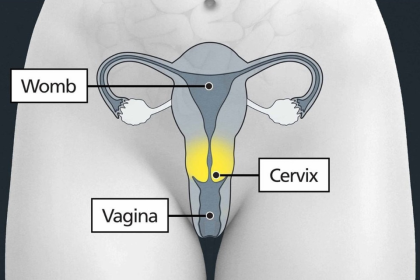 A diagram of the female reproductive system labelling the womb, cervix and vagina