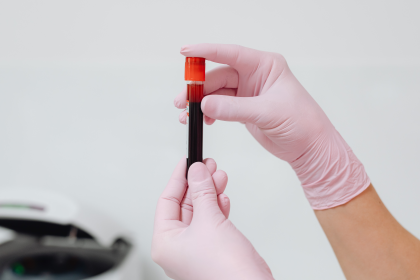 A photo of a person wearing pink medical gloves holding a vial of blood 