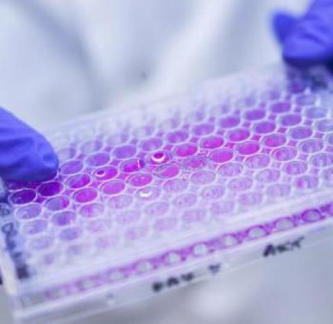 A closeup of a researcher wearing gloves while holding lab equipment