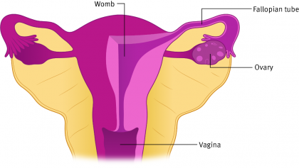 A close-up illustration of the ovaries, fallopian tubes, womb and vagina