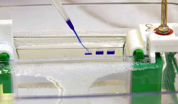 Lab equipment used in ovarian cancer research