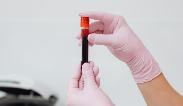 A photo of a person wearing pink medical gloves holding a vial of blood 
