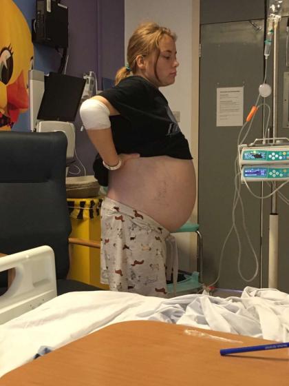 Rosie in hospital with a swollen abdomen 